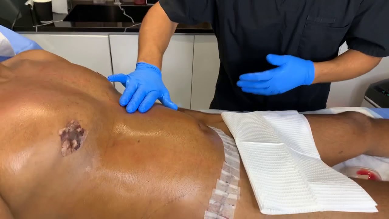 How Often Should You Get A Massage After Lipo