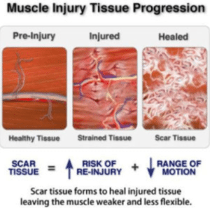 What Happens To Your Body During A Deep Tissue Massage