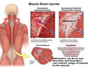 What Happens To Your Body During A Deep Tissue Massage